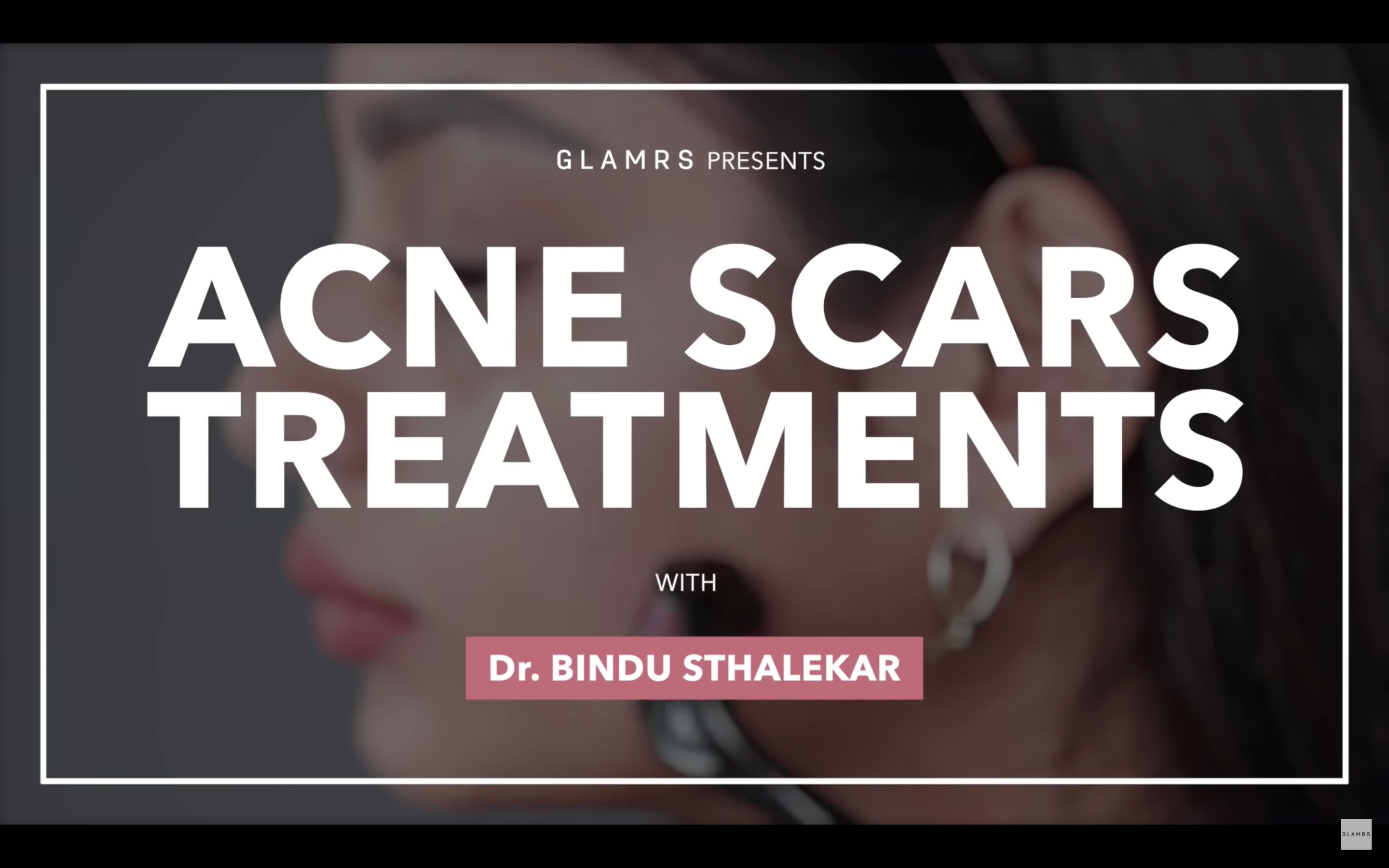 Acne scar treatments